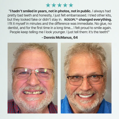 🌎Ends Today: 70% OFF! - Custom-Fit Full Functional Dentures Make you more confident✨