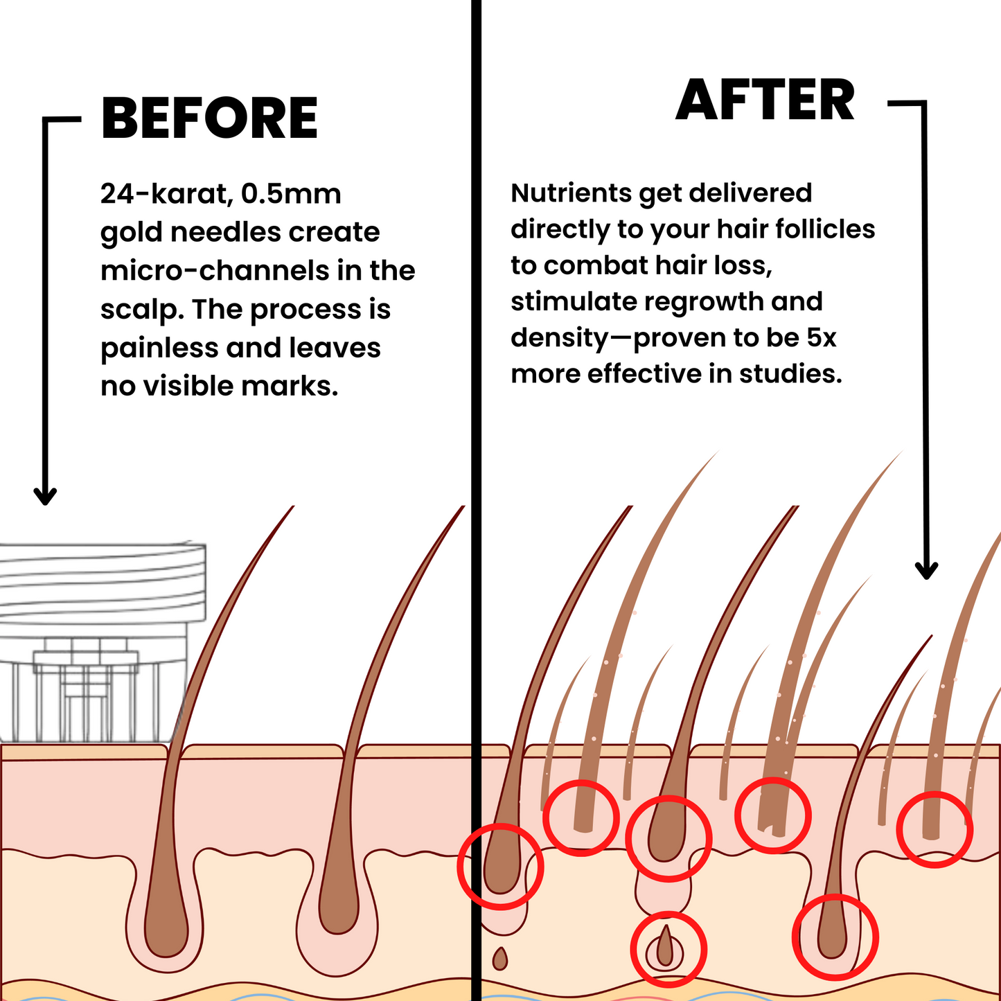 Voraid™ Alpha Hair Regrowth System