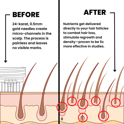 Voraid™ Alpha Hair Regrowth System
